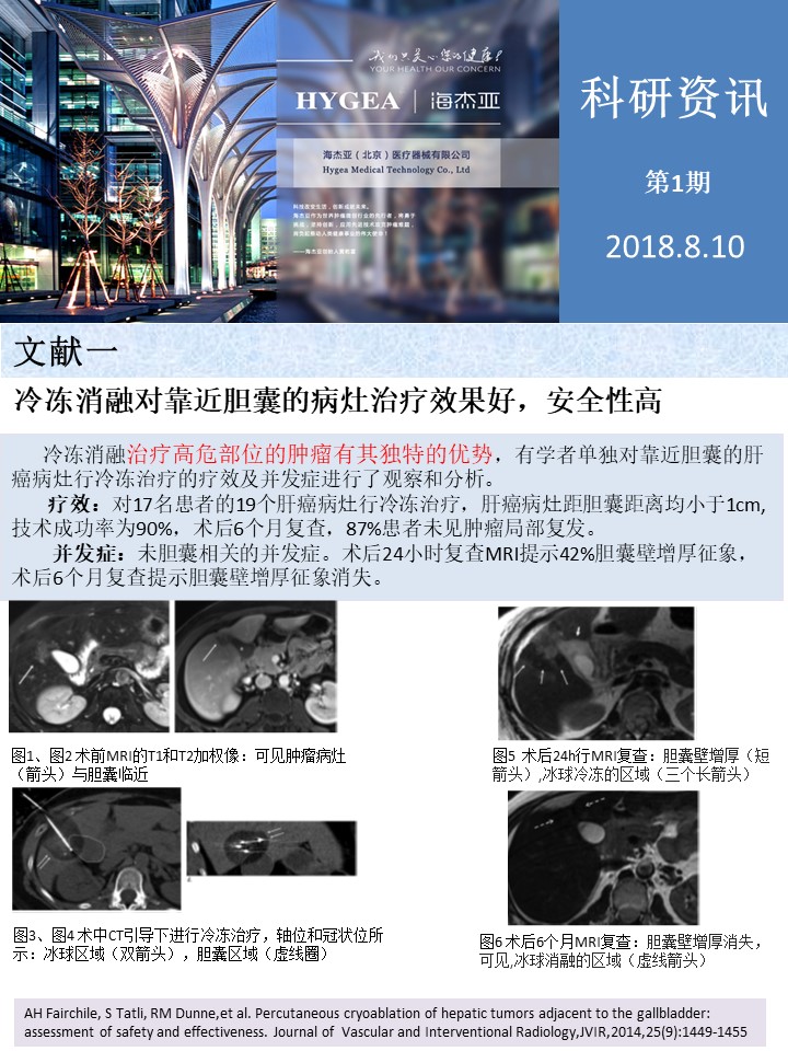 【海杰亞科研資訊】第1期——肝、肺癌消融